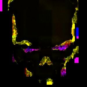 Meet your Posher, Nolan